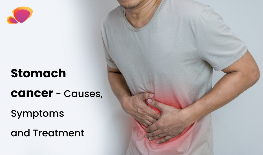 Excellence in Stomach Cancer Care in Trichy